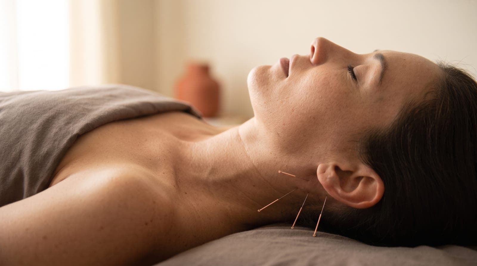 A woman lying relaxed on a treatment table with several fine acupuncture needles placed along the base of her skull and upper neck.