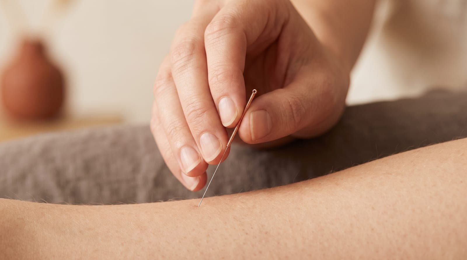 Close-up of a practitioner's hand gently placing a single hair-thin acupuncture needle into a relaxed forearm.