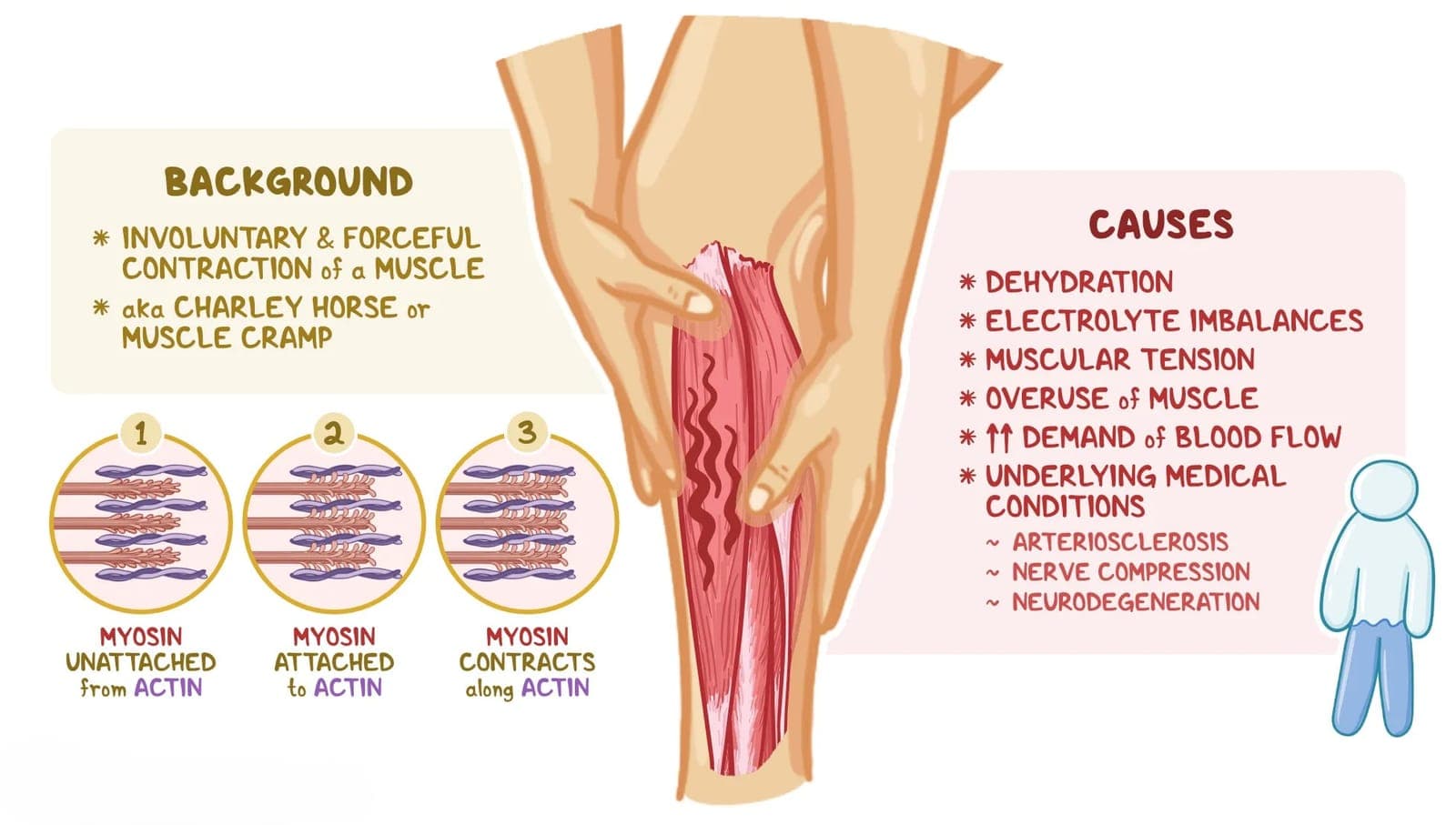 Anatomy infographic showing muscle cramp causes and the myosin-actin contraction cycle inside muscle fibers.